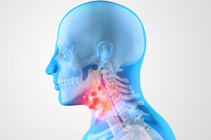 Head and neck tumors 