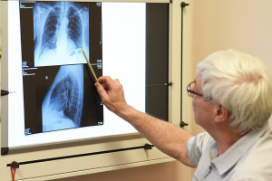 Выявление и лечение рака легких в ЦАОП